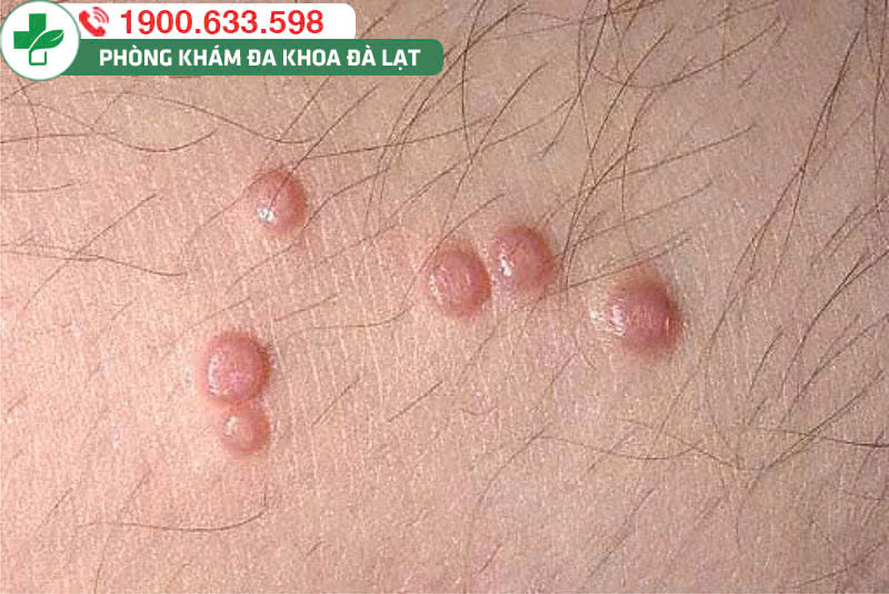 Hình ảnh minh họa